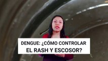 6 SOLUCIONES para TRATAR el RASH y PICAZÓN en la PIEL causado por el DENGUE
