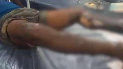 ఏలూరు జిల్లా: నిమజ్జనంలో అపశృతి... తీవ్ర గాయాలు