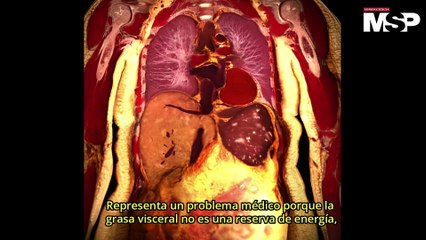 Qué es la obesidad y por qué es una enfermedad