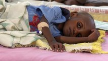 وفاة المئات من أطفال السودان بسبب سوء التغذية