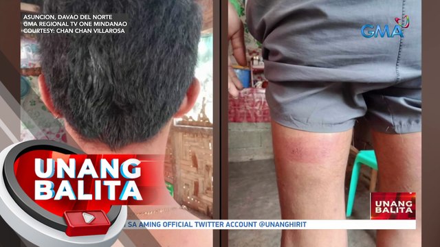 19-anyos na lalaki, binugbog umano ng pulis | UB