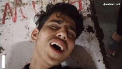 कोटा: नहीं थम रही चाकूबाजी वारदात, अब इस युवक पर हुआ हमला, देखिए पीड़ित जुबानी