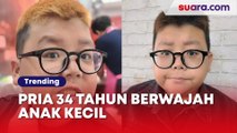 Punya Wajah Seperti Anak-anak padahal Sudah Berusia 34 Tahun, Pria Ini Bikin Orang Terheran Tak Percaya