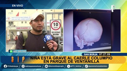 San Borja: niña sigue luchando por su vida tras caerle columpio sobre la cabeza en parque de Ventanilla