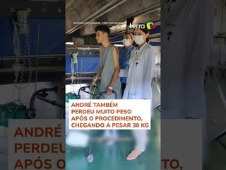 Jovem viraliza ao mostrar evolução no tratamento contra escoliose grave