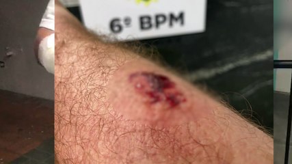 Professor é mordido por aluna ao separar briga em colégio