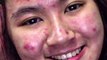 [ SAVE _ SHARE ] __Here this out gurls -- _ personal experience acne fighter __acne fighter ngumpul yuk share experience kalian juga di bawah with rose jelly mask ----‍♀️ ___jellymask _maskerviral(MP4)