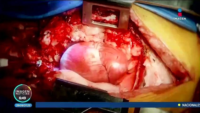 Enfermedades cardiovasculares, principal causa de muerte en México