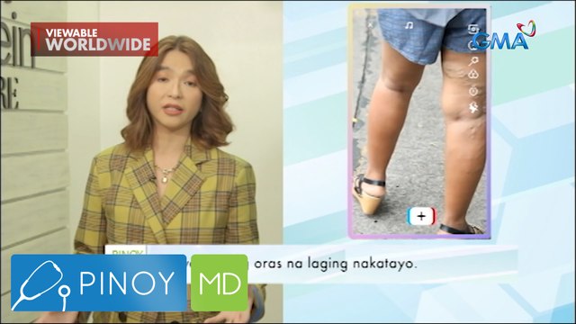 Saan ba nakukuha ang varicose veins at warts? | Pinoy MD