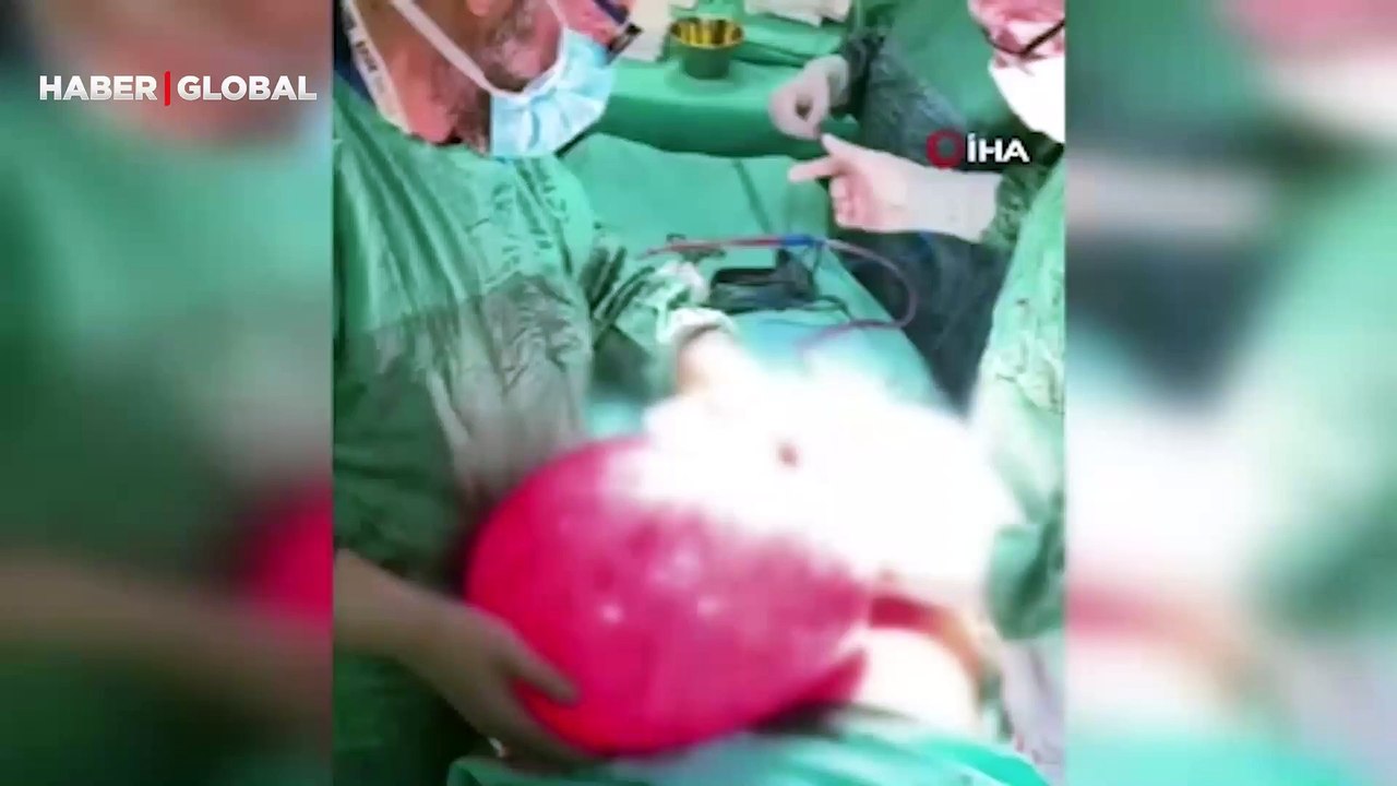 Hamile olduğunu sanıyordu karnından 15 kilo kist çıktı