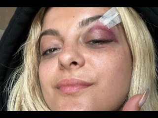 Suspect Allegedly Told Cops Why He Threw Phone at Bebe Rexha