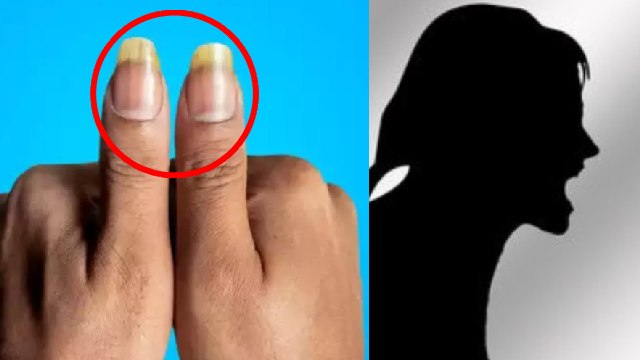 Nakhun Par Aadha Chand Ka Matlab | Nakhun Par Aadha Chand Kyon Hota Hai | Boldsky