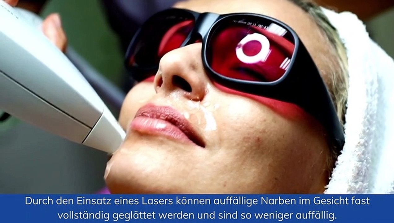 Laserbehandlung im Gesicht: Das NiSV Fachkundezertifikat macht es möglich