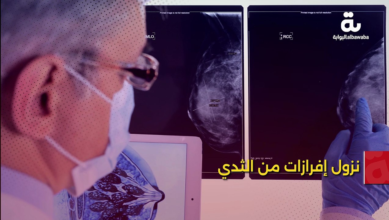 أعراض صامتة لـ سرطان الثدي