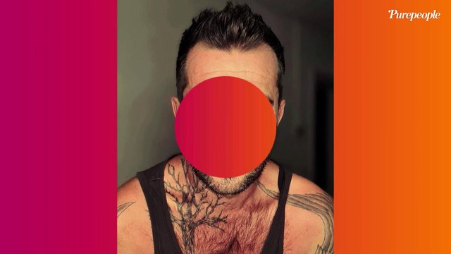 Mathieu (L'amour est dans le pré) attaqué par les punaises de lit : photo impressionnante de son corps recouvert de piqûres