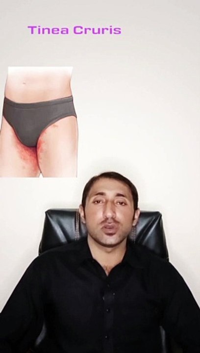 fungal infection in private parts _ Terbisil cream uses in urdu _ tinea cruris treatment