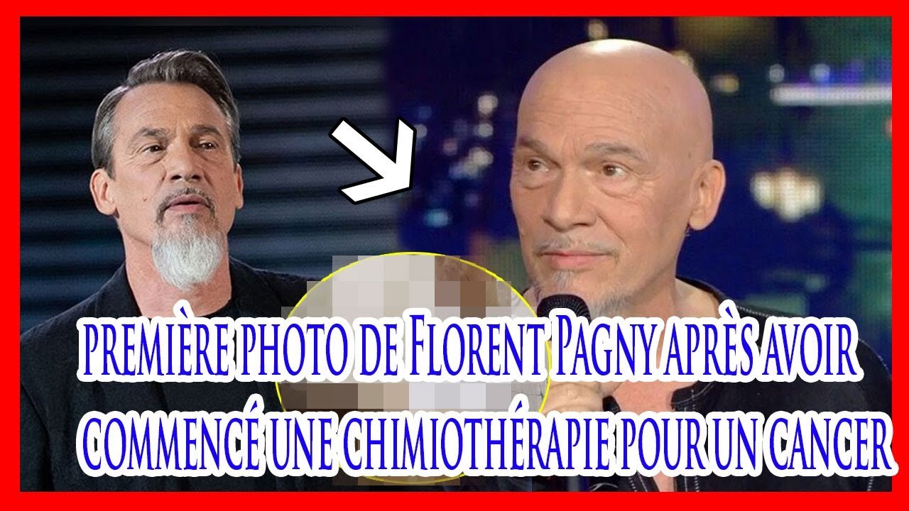 Choqué par la première photo de Florent Pagny après avoir commencé une chimiothérapie pour un cancer
