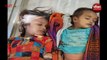 यहां नींद में सो रही दो बच्चियों की सर्पदंश से मौत, 12 घण्टे बाद अस्पताल लेकर पहुंचे परिजन, Watch Video