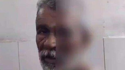 आगरा: कलयुगी बेटे ने बुजुर्ग पिता बड़े भाई और भाभी पर किया जानलेवा हमला