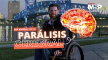 Día mundial de la parálisis cerebral: ¿Cómo funciona?
