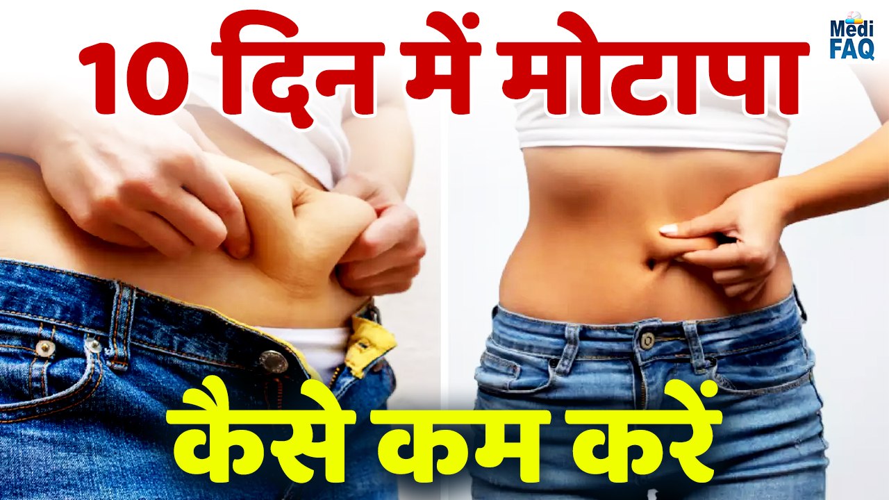 10 दिन में मोटापा कैसे कम करें ? How to Lose Weight in 10 Days | Motapa kaise kam kare tips  |