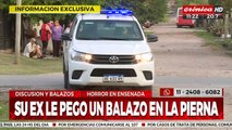 Su ex le pegó un balazo en la pierna, ella estaba embarazada de 40 semanas