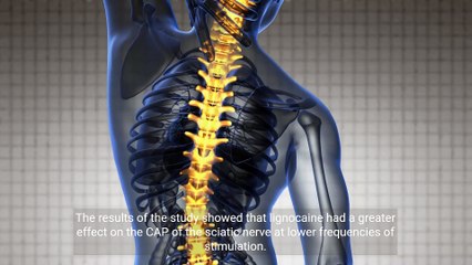 - Understanding the Mechanism of Action of Lignocaine