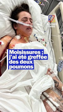 Marine a été greffée des deux poumons après avoir découvert de la moisissure dans son logement. Elle raconte. En intégralité sur YouTube !