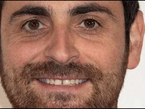 Camille Combal : cette maladie génétique qui a bouleversé sa vie...