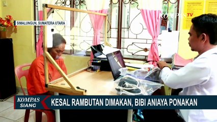 Penyesalan Tante yang Setrika Keponakan Hingga Alami Luka Bakar 30 Persen