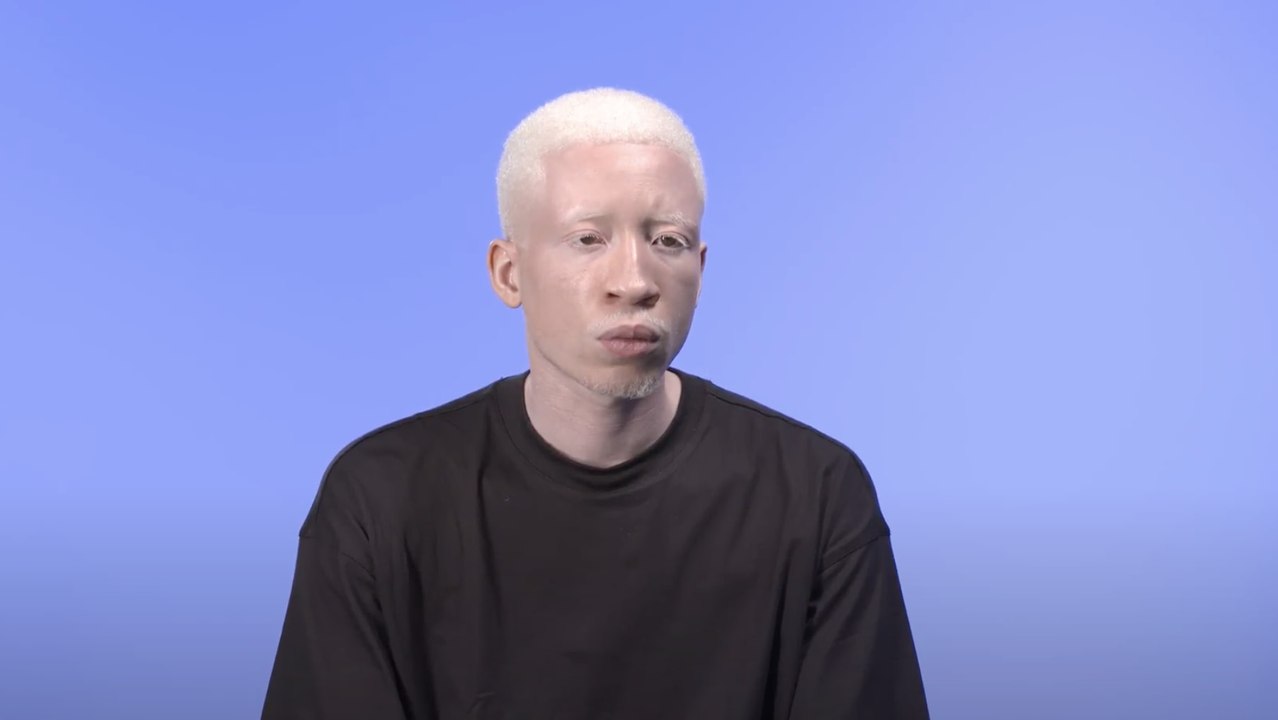 Charles Edouard, albinos : "Le mannequinat a transformé toutes mes faiblesses en force, aujourd’hui, je me bats pour exceller dans ce domaine"