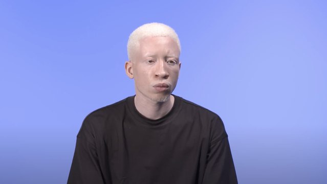 Charles Edouard, albinos : Le mannequinat a transformé toutes mes faiblesses en force, aujourd’hui, je me bats pour exceller dans ce domaine