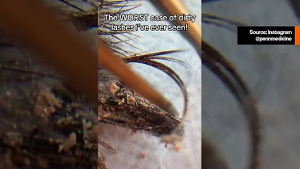 Kosmetologi jakaa videon huonoimmista tekoripsistä, joita hän on nähnyt, ja järkyttää internetiä