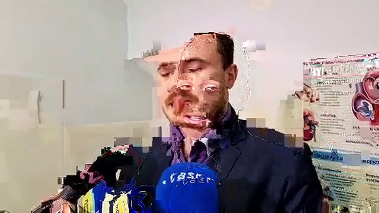 ZÁZNAM: Situácia so žltačkou v okrese Prešov sa podľa hygienikov zlepšuje
