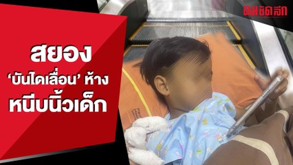 สยอง 'บันไดเลื่อน' ห้าง หนีบนิ้วมือเด็ก 4 ขวบ  | คมSocial