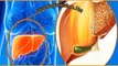 17 beneficios de tomar citrato de magnesio para hígado graso