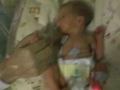 Zazou dans sa couveuse première partie