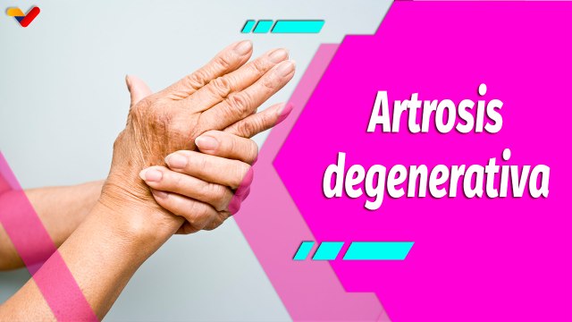 Buena Vibra | Artrosis, trastorno degenerativo de las articulaciones