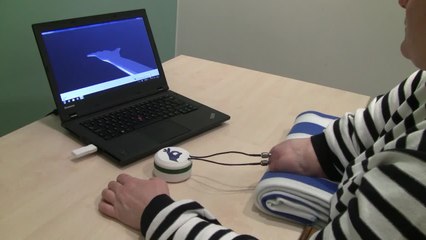 La prótesis neuronal que permite tener sensaciones a personas amputadas