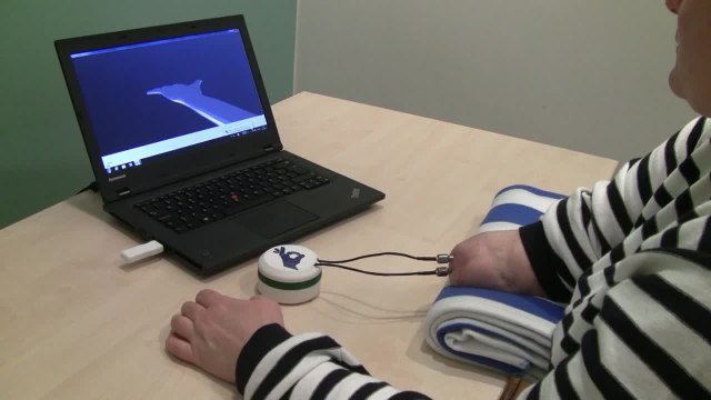 La prótesis neuronal que permite tener sensaciones a personas amputadas