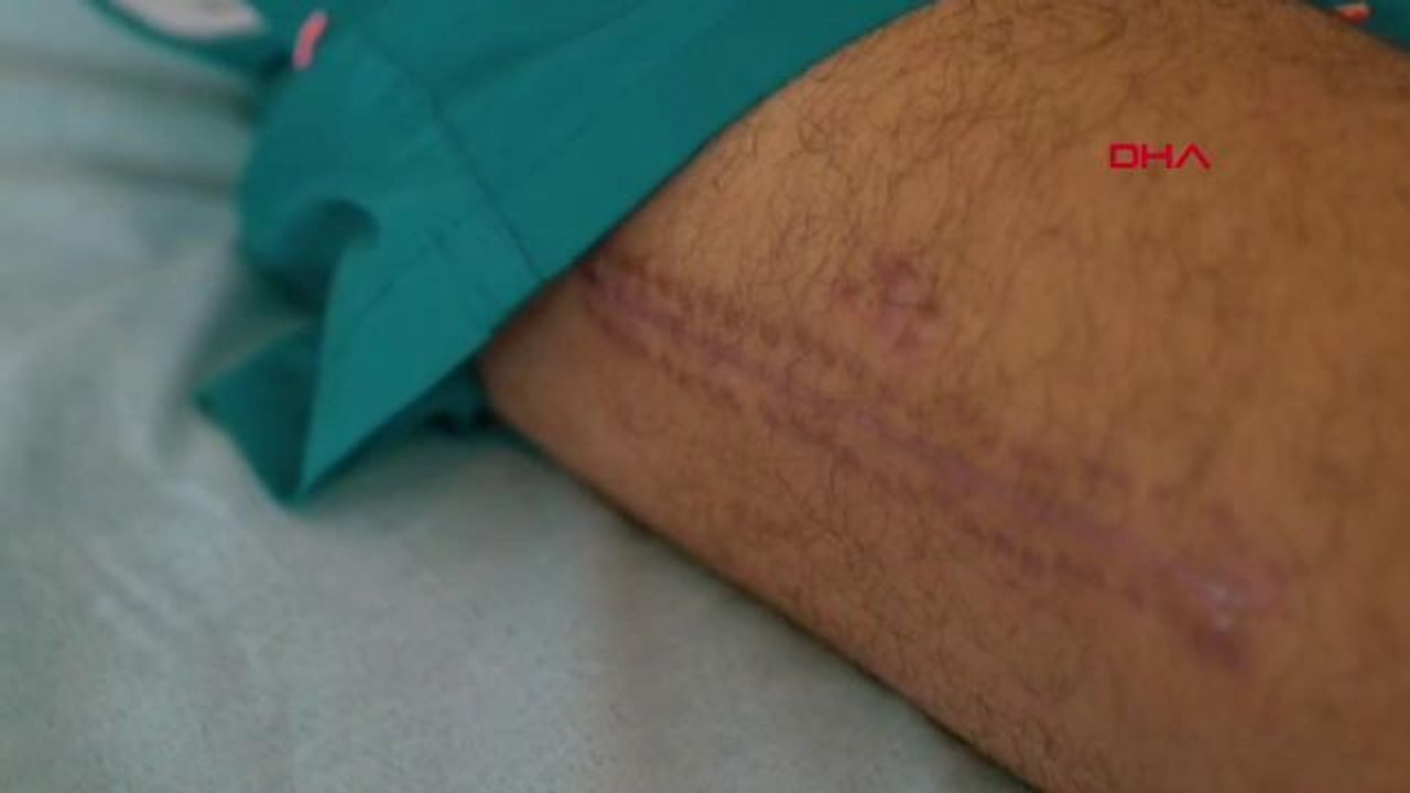 Motosiklet Kazası Sonrası Kaskın Önemi Anlatıldı