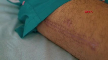 Motosiklet Kazası Sonrası Kaskın Önemi Anlatıldı