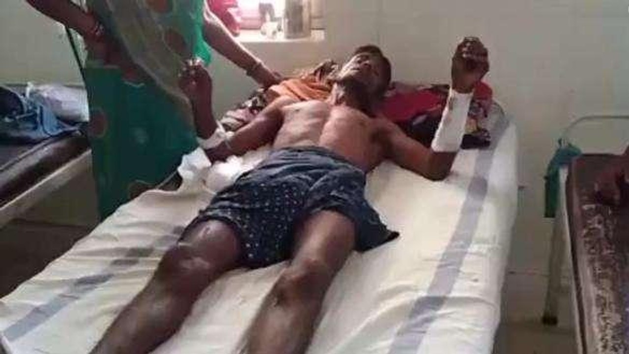 सावधान: आबादी में घूम रहा है बाघ, युवक पर हमला कर की ऐसी हालत..