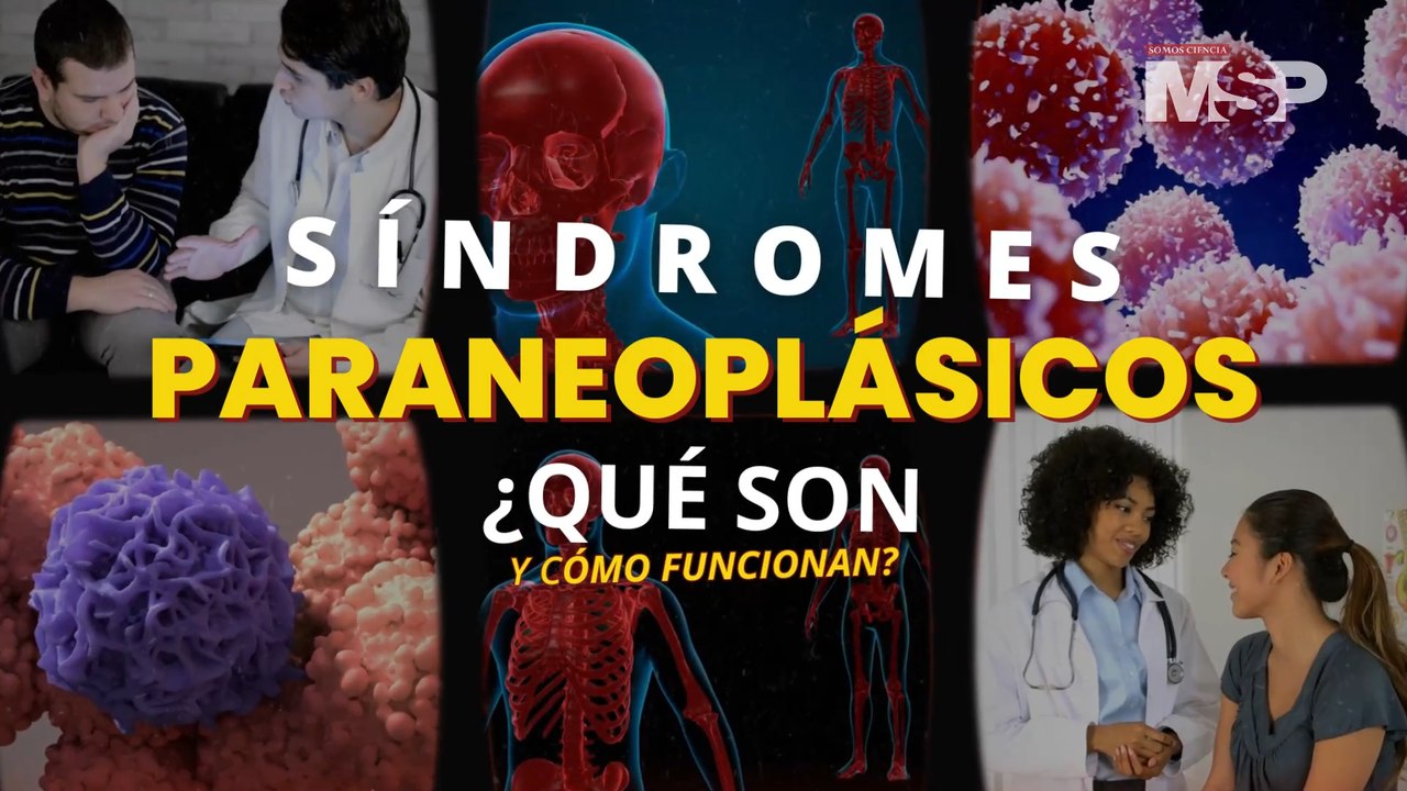 Síndromes paraneoplásicos: ¿Qué son y cómo funcionan? - #ExclusivoMSP