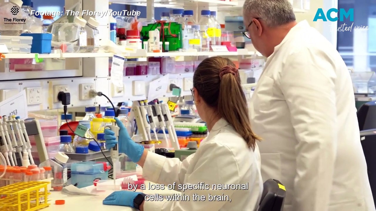 Detecting Parkinson’s disease decades before symptoms appear | The Senior | October 17, 2023