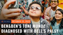 Ben&Ben's Toni Muñoz diagnosed with Bell's palsy