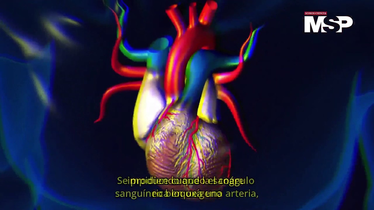 Día Mundial de la Trombosis: Conoce los 2 tipos principales de trombosis - #MSP