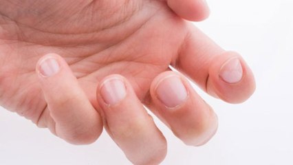 Parmak ve tırnaklara dikkat!