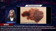 Melanoma now no longer the leading cause of skin cancer deaths - these are