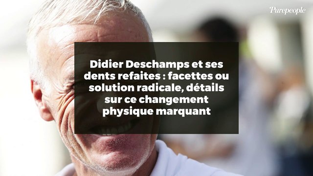 Didier Deschamps et ses dents refaites : facettes ou solution radicale, détails sur ce changement physique marquant